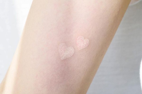 white-tattoo-before-the-scar-822x1024.jpg